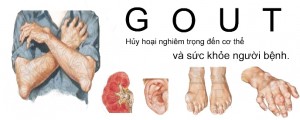 Benh-gout-gut-va-nhung-bien-chung-nguy-hiem