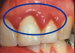 nha-khoa-drhung-nha-chu6