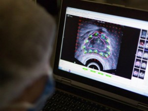 ung-thu-tuyen-tien-liet-4803-1500175239