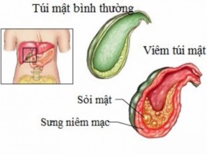 0240_tui-mat_JNUE_thumb