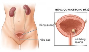 Soi-bang-quang-hinh-thanh-do-dau