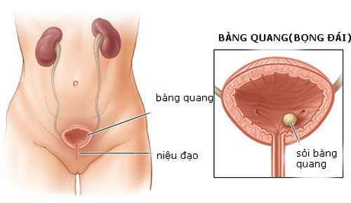 Soi-bang-quang-hinh-thanh-do-dau