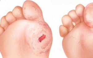 photo-1-1510561395860-0-15-292-486-crop-1510561557439