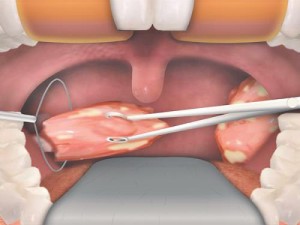 24092015083510health1_28174458