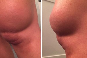 tran-dich-khop-goi-co-nguy-hiem-den-tinh-mang_13018766