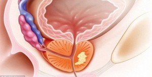 tuyến tiền liệt
