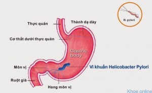 viem-da-day-hp-600x369