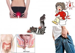 cach-chua-benh-tri-bang-phuong-phap-tu-nhien