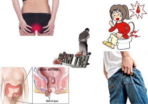 cach-chua-benh-tri-bang-phuong-phap-tu-nhien