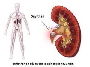 dau-hieu-ban-bi-suy-than-man-ma-chang-he-biet-benh-suy-than-1520951774-270-width512height384