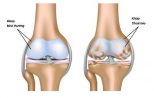 2800-thoai-hoa-khop5