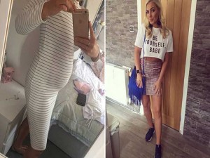 1541859239-392-co-gai-tre-mac-benh-hiem-gap-khien-bung-cu-nhu-nguoi-co-bau-5-thang-khong-chiu-sinh-0-1541566084-width640height480