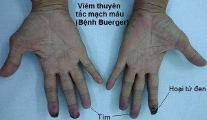 viem-nut-dong-mach4-1545886610472490576401