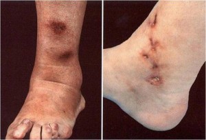 viem-nut-dong-mach5-1545886641328299592729