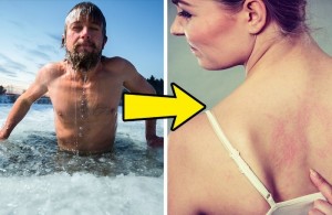 3-unusual-allergy-symptoms-we-often-mistake-for-other-diseases-1502357