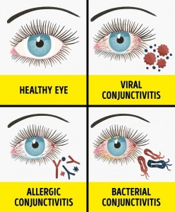 4-unusual-allergy-symptoms-we-often-mistake-for-other-diseases-150249568