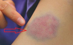 co-the-cua-ban-dang-co-dau-hieu-lao-hoa-som-neu-gap-phai-hang-loat-van-3e0dfc