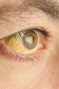 12-what-eyes-say-about-your-health-164035192