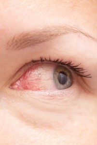 3-what-eyes-say-about-your-health-163844043