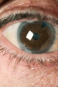 7-what-eyes-say-about-your-health-163938268