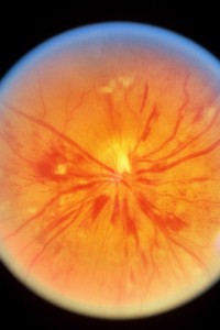 8-what-eyes-say-about-your-health-163950997